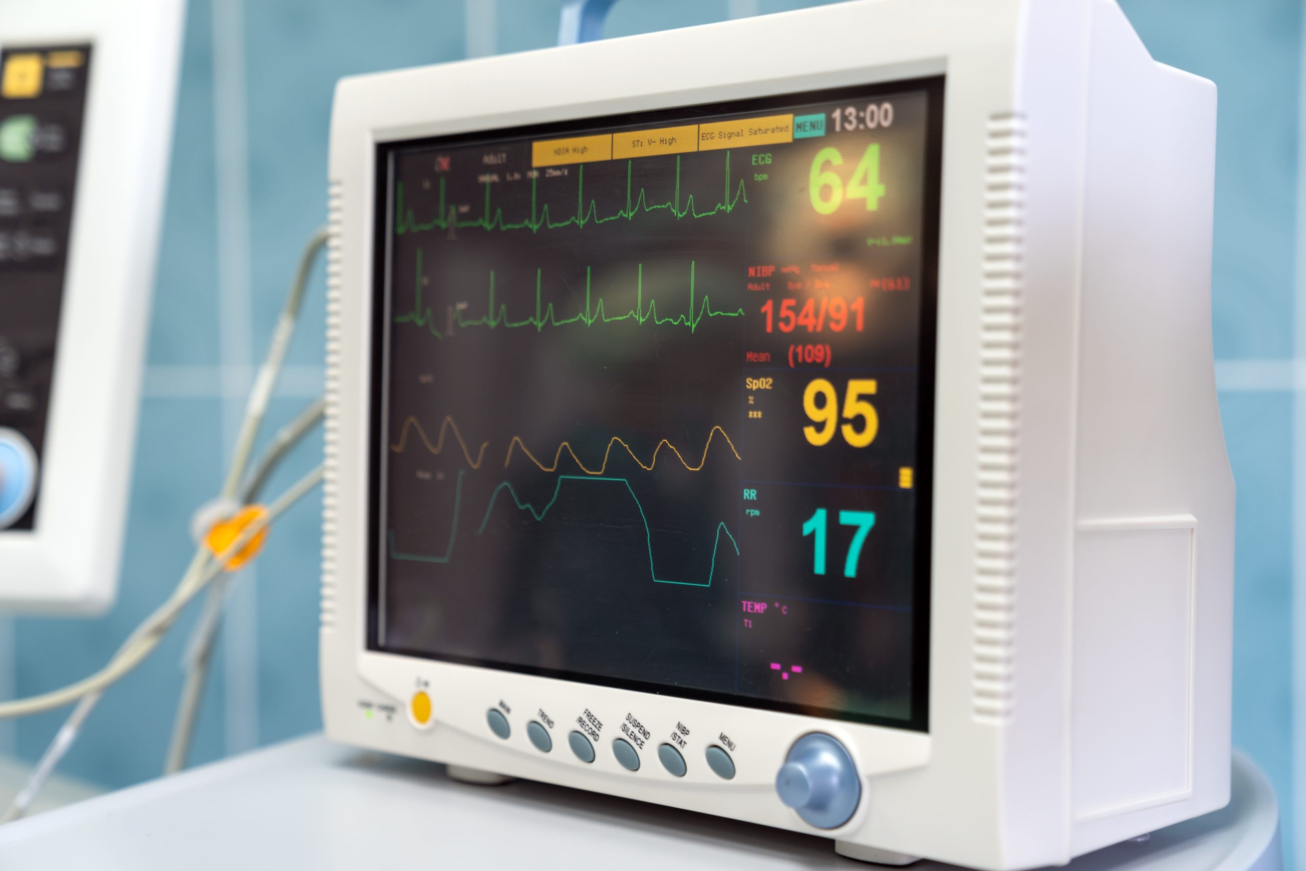 ECG EKG machine used for cardiac monitoring and diagnostic evaluation.